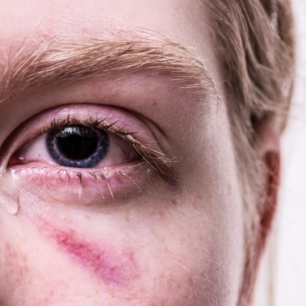 Everything you need to know about the crime of injuries against people